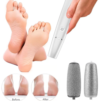 🏆Last Day Sale - Only ￡9.99!🔥Flash Sale⚡50K+ SOLD!💥💕Electric Feet Callus Remover🎁1 * Replacement Head Included