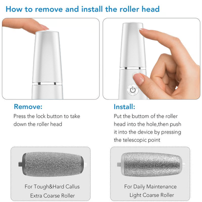 🏆Last Day Sale - Only ￡9.99!🔥Flash Sale⚡50K+ SOLD!💥💕Electric Feet Callus Remover🎁1 * Replacement Head Included