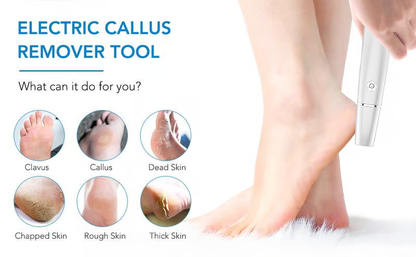 🏆Last Day Sale - Only ￡9.99!🔥Flash Sale⚡50K+ SOLD!💥💕Electric Feet Callus Remover🎁1 * Replacement Head Included
