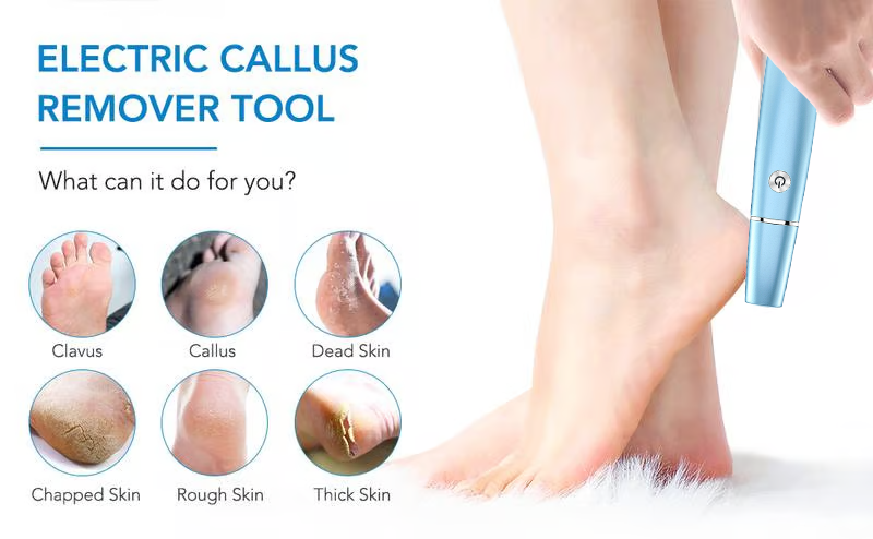 🔥Hot Sale - 50% OFF🔥Electric Feet Callus Remover⚡