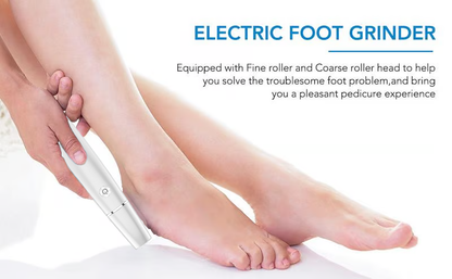 🏆Last Day Sale - Only ￡9.99!🔥Flash Sale⚡50K+ SOLD!💥💕Electric Feet Callus Remover🎁1 * Replacement Head Included