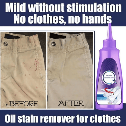 🔥Hot Sale🔥Active Enzyme Laundry Stain Remover🎁Buy 2 Get 1 Free&Free Shipping