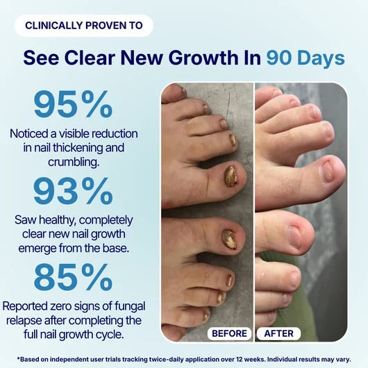 ADVANCED FUNGAL NAIL REPAIR PEN