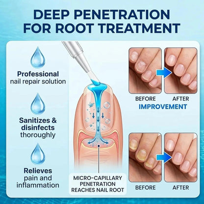 ADVANCED FUNGAL NAIL REPAIR PEN