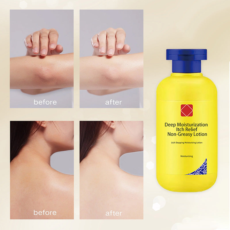 🔥Hot promotion 49% OFF🔥Deep moisturizing itch relief Non-greasy lotion
