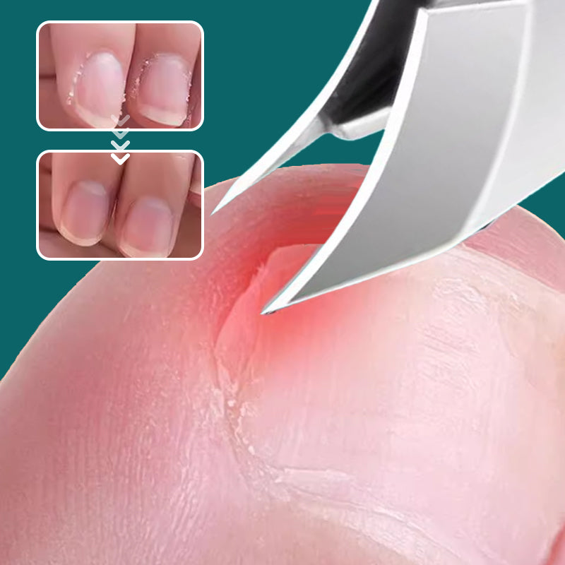 🔥Limited SALE 50% OFF🎁 Anti-Splash 25° Slant Edge Nail Clipper 3-Piece Set