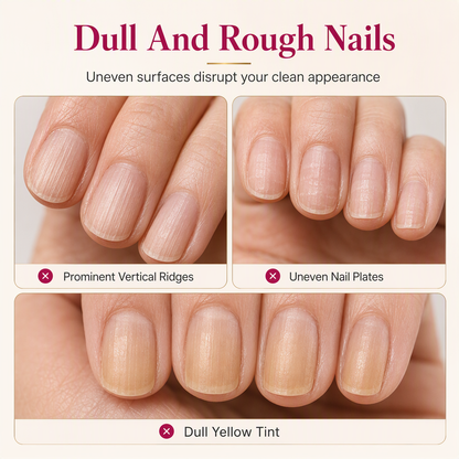 Natural Pink Nail Ridge Filler